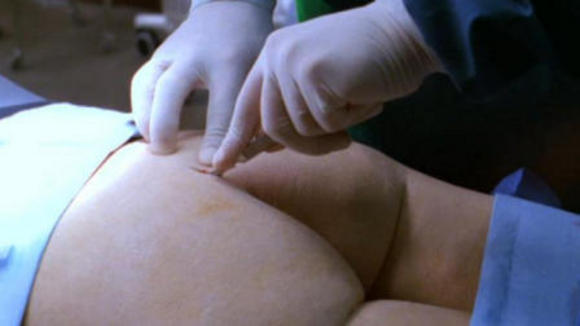 Photo from the movie Nip/Tuck